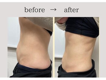 アネーロ(anhelo)/痩身で美ボディは作れる♪