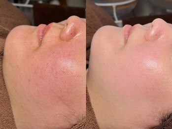 ルーナジェーナ(Luna llena)/池袋　エステ　ルーナジェーナ