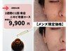 【メンズ限定】ニキビケア・肌荒れ・毛穴洗浄【２週間以内】¥14,850→¥9,900