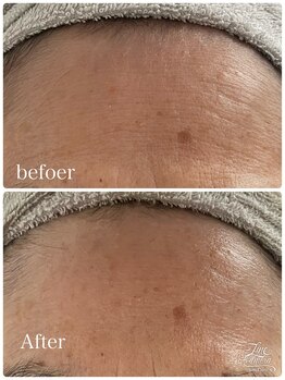 リッチベル(richbelle)/