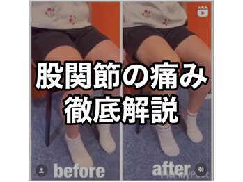カワル整体 上通り院/股関節の痛みを解説します。