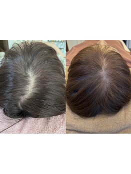 ヘッドスパで癒されたい