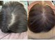ココシア(CoCosia)の写真/最新鋭マシーン導入！頭皮の毛穴にアプローチし、育毛を促進◎美髪を目指すあなたに、理想的なケアを提供♪