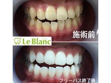 ルブラン 奈良店(Le Blanc)/コーヒー好き必見！