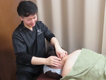 つつじが岡整骨院 鍼灸院/鍼施術