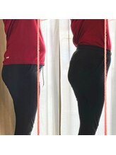 ザ コンディショニングルーム コガオスタジオ 自由が丘店(KOGAOSTUDIO)/ビフォーアフター　お腹