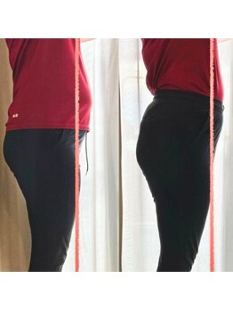 ザ コンディショニングルーム コガオスタジオ 自由が丘店(KOGAOSTUDIO)/ビフォーアフター　お腹