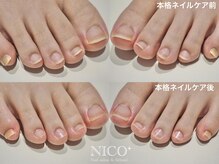 ニコプラス(NICO+)/爪育ネイルケア