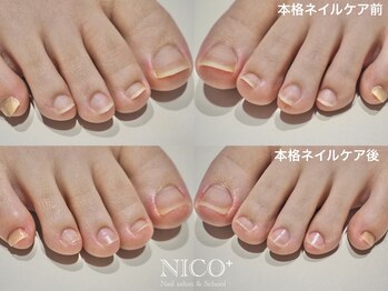 ニコプラス(NICO+)/爪育ネイルケア