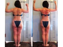 痩身 セル脂肪専門 スタイルデザイン/2023ベストボディSD★総合優勝２