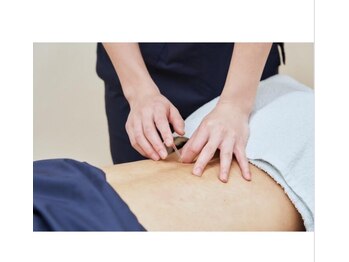 高田馬場名倉堂鍼灸接骨院/鍼灸も行っております