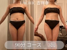 ラシク 吉祥寺(LACHIC)/デコルテすっきり！