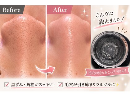 プロッソル こころ(PROSOL)の写真