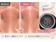 プロッソル こころ(PROSOL)の写真