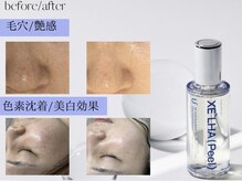 iris by cherir 浦和店【イリスバイシェリール】【7/1OPEN（予定）】/セラピール【艶/美白/くすみ】