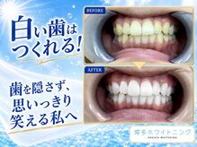 博多ホワイトニング福岡 博多駅前筑紫口店