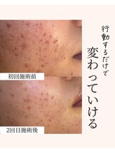 アネラ(Anela)/行動するだけで変わっていける