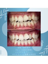 ブランコ 浦和駅前店(Blanco)/ホームケアも大事！