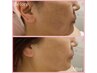 【8月限定】ノーファンデ美肌プログラム！毛穴&美白集中ケア16500円→9800円