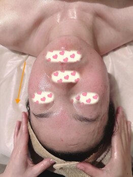 アムール(Amour)/ハイパーナイフ小顔＋コルギ