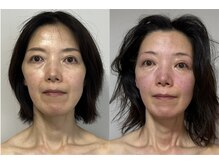 プリマヴェーラ/眼精疲労は放置させないで！