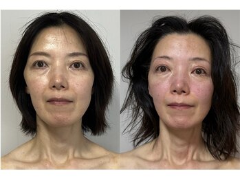 プリマヴェーラ/眼精疲労は放置させないで!