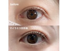 トトルナ(totoluna)の雰囲気（マイラミネーションのまつ毛パーマで太く、ハリのある仕上がりへ）