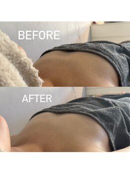 リボーン(Reborn)/