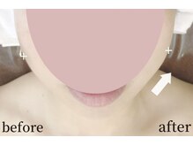 ガーデン(Garden)/滋賀彦根/たるみ改善専門Garden