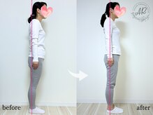 エーアール(AR)/【Before/After】3回目