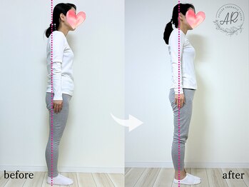 エーアール(AR)/【Before/After】3回目