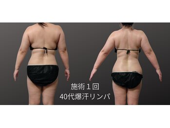 フロレゾン(Floraison)/全身痩せちゃう~