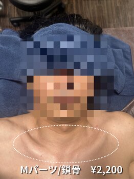 カナウ(KANAU)/【Mパーツ/脱毛】鎖骨周り