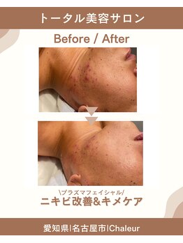 シャルール プラス(Chaleur+)/