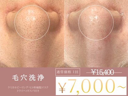 ルーミー 南青山(LUME)の写真