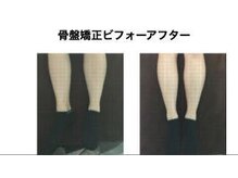 やち鍼灸院/骨盤を整えて美脚に！