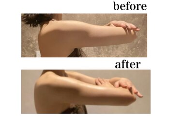 銀座レイア/ブライダルビフォーアフター