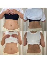 エン ボディアンドフェイシャル(En)/腸セラピー/腸もみ　５回