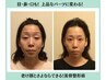 目元ぱっちり/きれいな鼻筋/上品口元/パーツバランスを整え若見え黄金比小顔