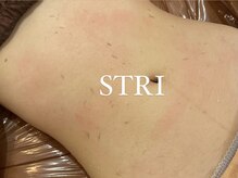 ストリ(STRI)/あかすり+よもぎ蒸しの整い施術