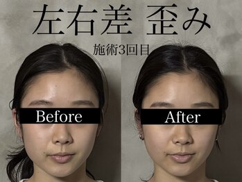 オアシストウキョウ 表参道(OASIS TOKYO)/左右差/歪みのお悩み