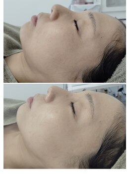 ビーユー(Be.you)/健康的な水光肌