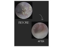 ベル(Bell)/耳掃除