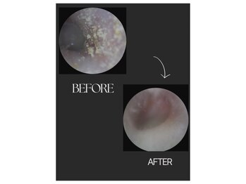 ベル(Bell)/耳掃除