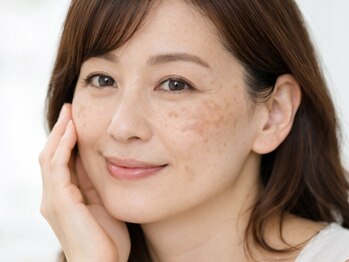 ママナ(mamana)の写真/韓国で人気のシミケア★white lab(ホワイトラボ)導入!諦める前に話題のシミ改善をお試し下さい◎