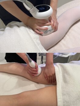 ビラ 銀座店(BILA)の写真/美脚は今からスタート!【痩せづらい体にBILAボディ】40代以上限定/インフィニティ×キャビラジ60分¥8800