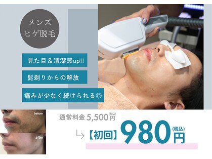 ビアラ(VIALA)の写真