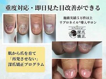 ブルームーンネイルズ(BLOOMOON.nails)の雰囲気(【深爪/噛み爪/むしり爪】気になるお爪の悩みご相談ください)