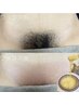 剃るよりも2週間以上ツルツルが持続◎チクチクなし！　VIO  wax脱毛   ￥5,900