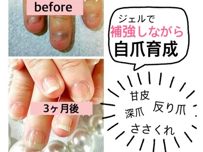 ヤヤネイル(ya+ya nail)の写真